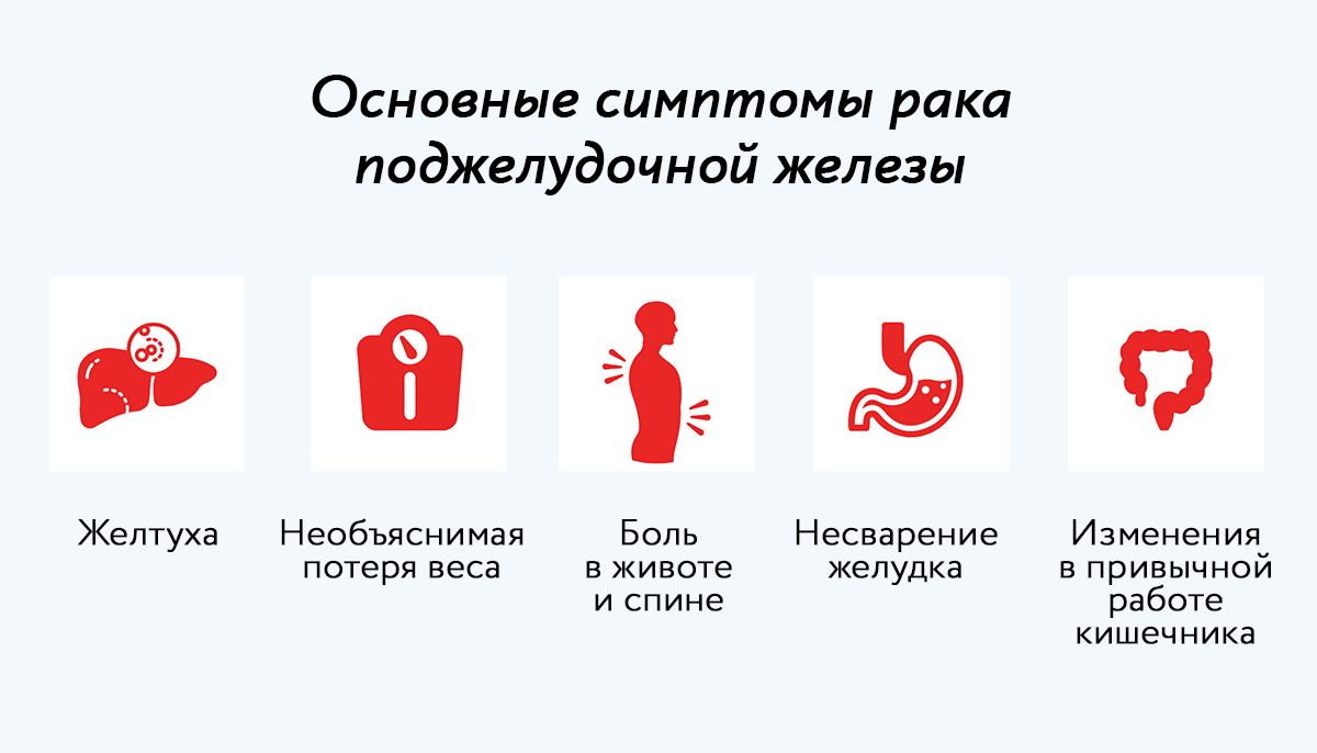 Основные симптомы рака поджелудочной железы Основные симптомы рака поджелудочной железы