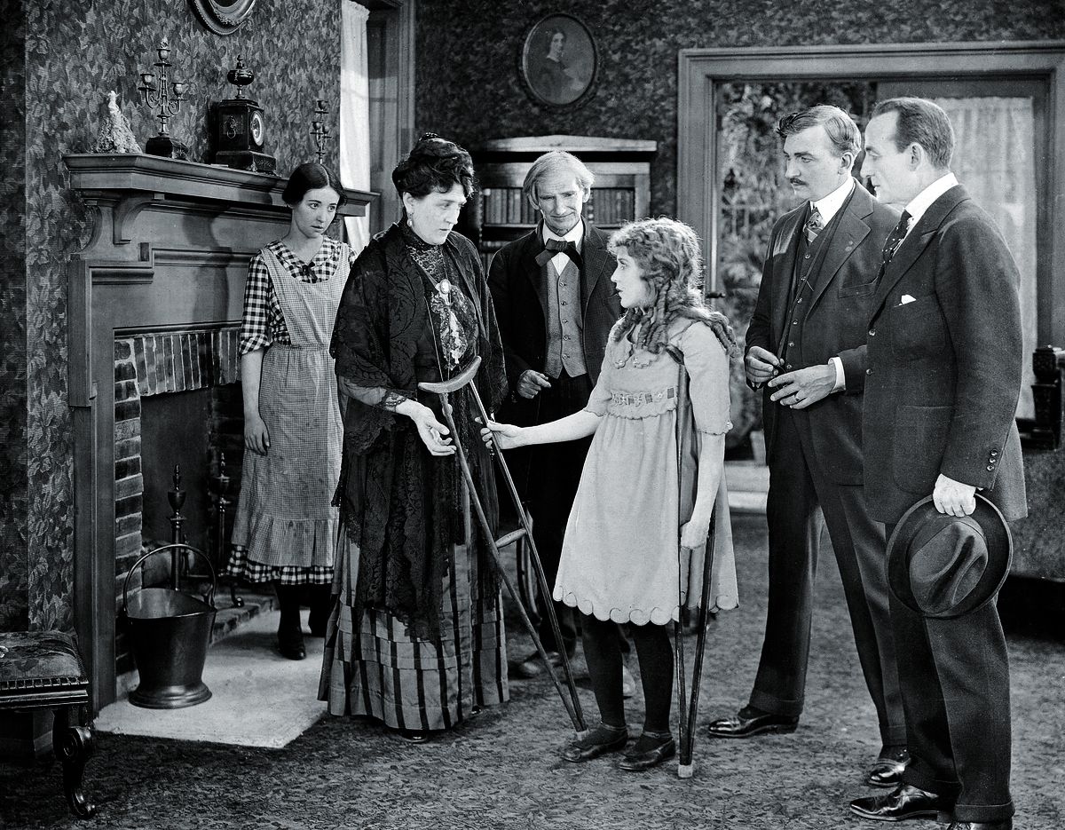 Мэри Пикфорд на костылях в главной роли в фильме «Поллианна», 1920 г. Мэри Пикфорд на костылях в главной роли в фильме «Поллианна»
